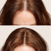 Scalpify Biberiye Şampuan | Dökülme Karşıtı ve Saç Uzamasını Destekleyici Biotin + Peptit