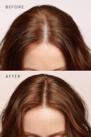 Scalpify Rosemary | Scalp Tonic (Mist) 100 ml