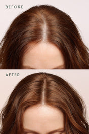 Scalpify Saç Toniği | Dökülme Karşıtı & Hacim Destekleyici Biberiye + Spirulina + Vitamin Kompleksi