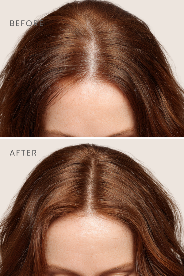 Scalpify Biberiyeli | Saç Derisi Bakım 5’li Set (Şampuan + Mist + Serum + Pre-Wash + Pop Gloss)